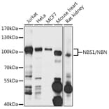 Western Blot - Anti-NBS1 Antibody (A10204) - Antibodies.com