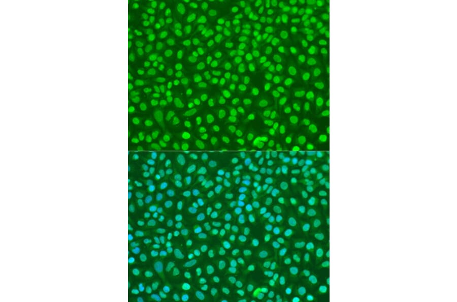 Immunofluorescence - Anti-NBS1 Antibody (A10204) - Antibodies.com