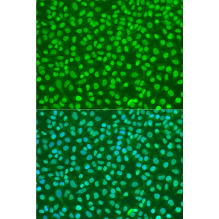 Immunofluorescence - Anti-NBS1 Antibody (A10204) - Antibodies.com