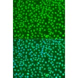 Immunofluorescence - Anti-NBS1 Antibody (A10204) - Antibodies.com