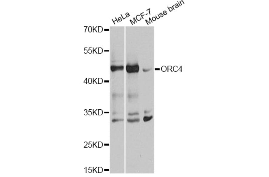 Western Blot - Anti-ORC4L Antibody (A7705) - Antibodies.com