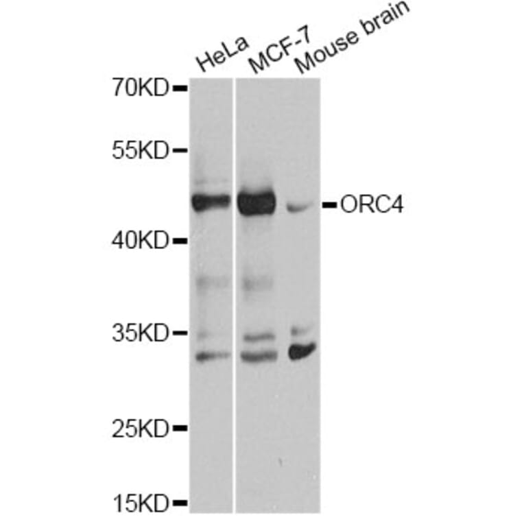Western Blot - Anti-ORC4L Antibody (A7705) - Antibodies.com
