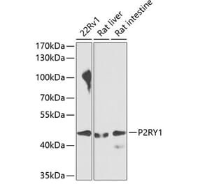 Western Blot - Anti-P2Y1 Antibody (A10206) - Antibodies.com