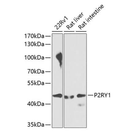 Western Blot - Anti-P2Y1 Antibody (A10206) - Antibodies.com