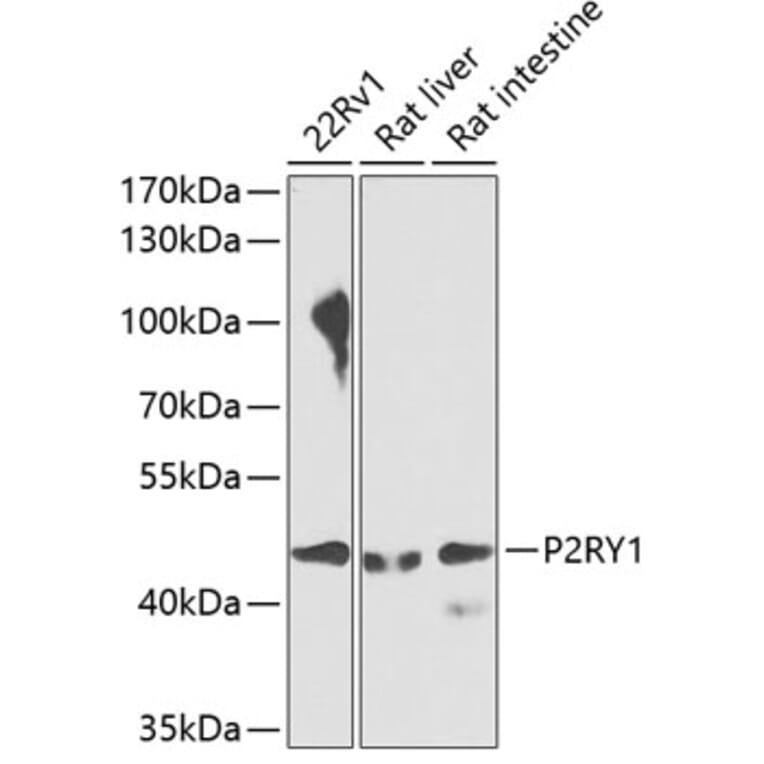 Western Blot - Anti-P2Y1 Antibody (A10206) - Antibodies.com