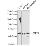 Western Blot - Anti-P2Y1 Antibody (A10206) - Antibodies.com