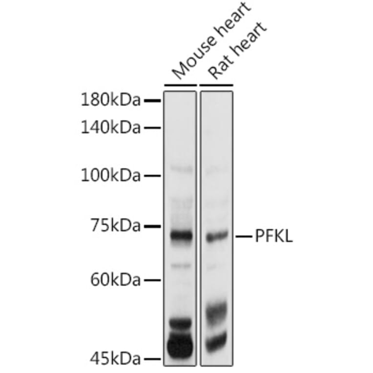 Western Blot - Anti-PFKL Antibody (A10207) - Antibodies.com