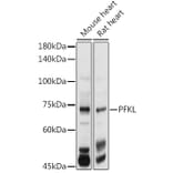 Western Blot - Anti-PFKL Antibody (A10207) - Antibodies.com