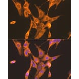 Immunofluorescence - Anti-PFKL Antibody (A10207) - Antibodies.com