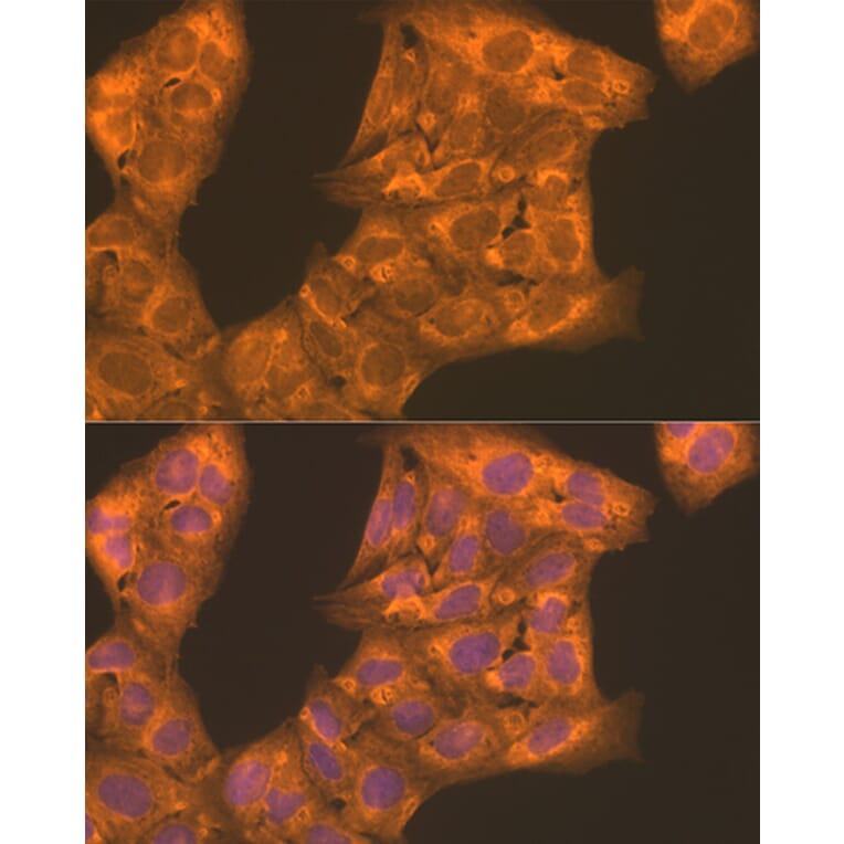 Immunofluorescence - Anti-PFKL Antibody (A10207) - Antibodies.com