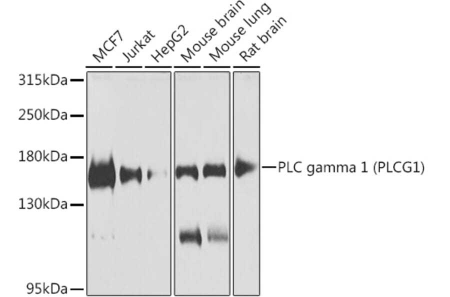Western Blot - Anti-Phospholipase C gamma 1/PLC-gamma-1 Antibody (A10208) - Antibodies.com