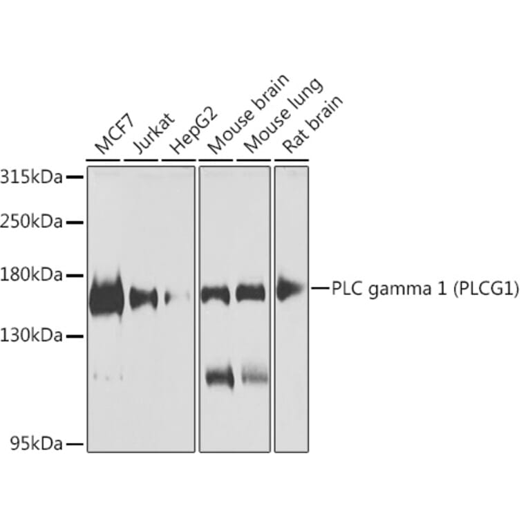 Western Blot - Anti-Phospholipase C gamma 1/PLC-gamma-1 Antibody (A10208) - Antibodies.com