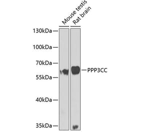 Western Blot - Anti-PPP3CC Antibody (A10209) - Antibodies.com