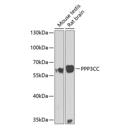 Western Blot - Anti-PPP3CC Antibody (A10209) - Antibodies.com