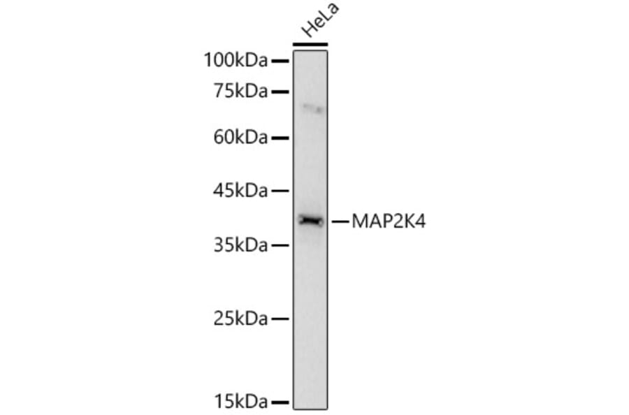 Western Blot - Anti-MEK4 / MKK4 Antibody (A10211) - Antibodies.com