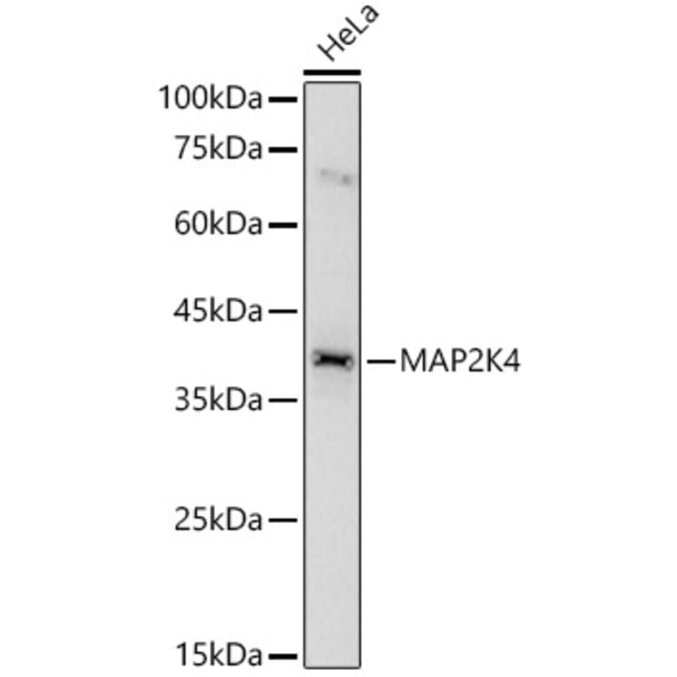 Western Blot - Anti-MEK4 / MKK4 Antibody (A10211) - Antibodies.com