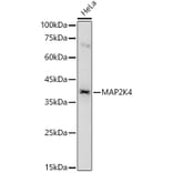 Western Blot - Anti-MEK4 / MKK4 Antibody (A10211) - Antibodies.com