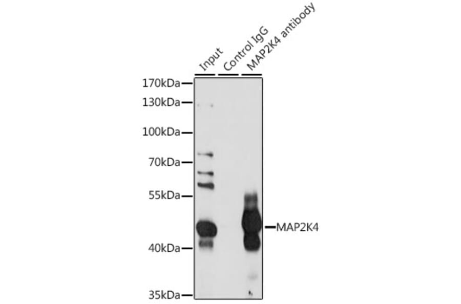 Western Blot - Anti-MEK4 / MKK4 Antibody (A10211) - Antibodies.com