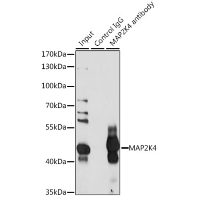 Western Blot - Anti-MEK4 / MKK4 Antibody (A10211) - Antibodies.com