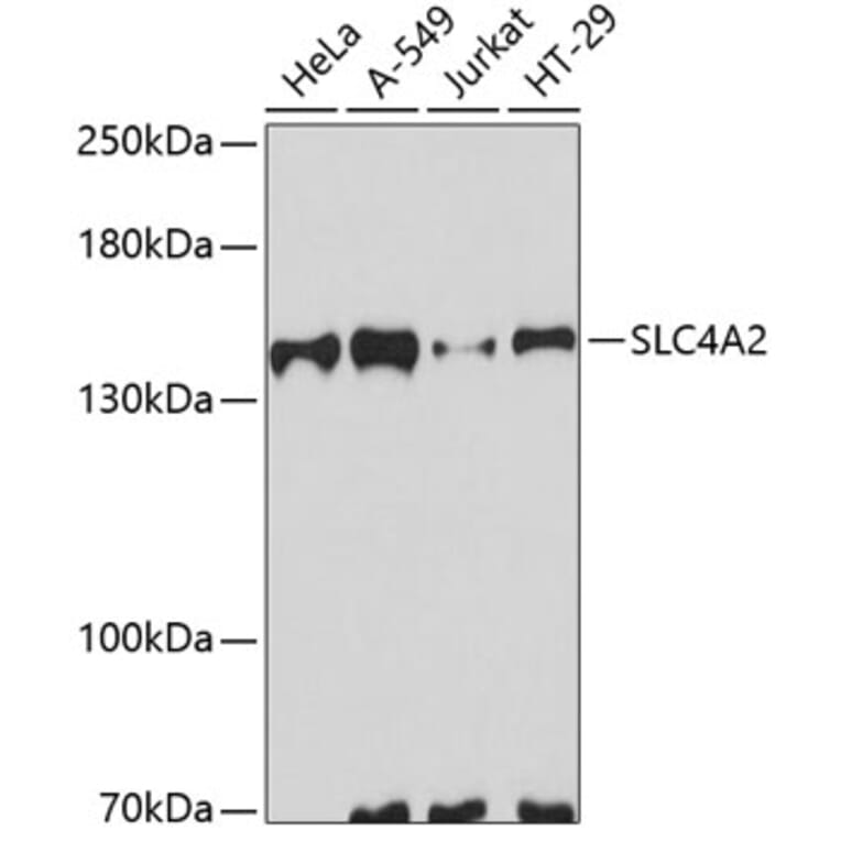 Western Blot - Anti-AE2 Antibody (A10212) - Antibodies.com