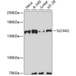 Western Blot - Anti-AE2 Antibody (A10212) - Antibodies.com