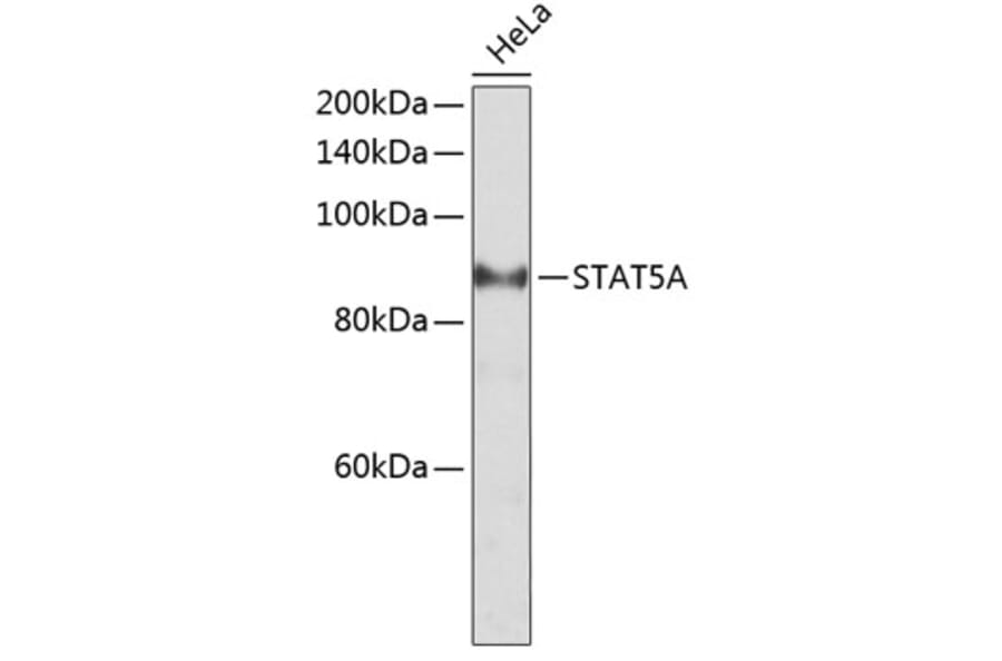 Western Blot - Anti-STAT5 Antibody (A10213) - Antibodies.com