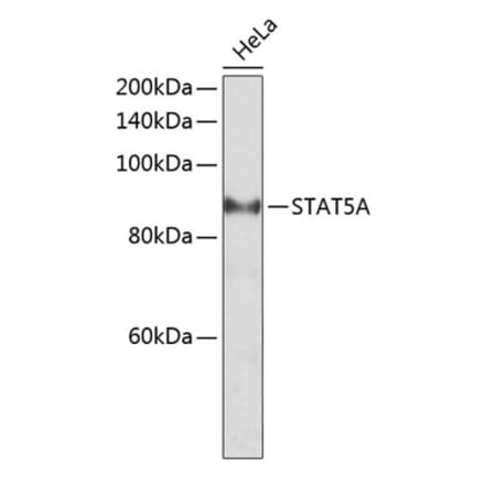 Western Blot - Anti-STAT5 Antibody (A10213) - Antibodies.com