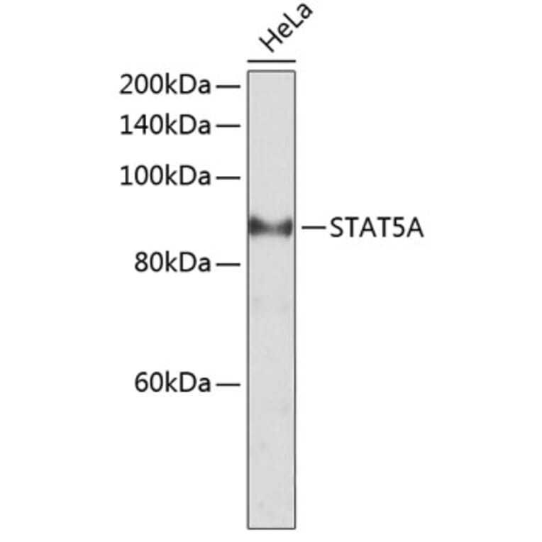 Western Blot - Anti-STAT5 Antibody (A10213) - Antibodies.com