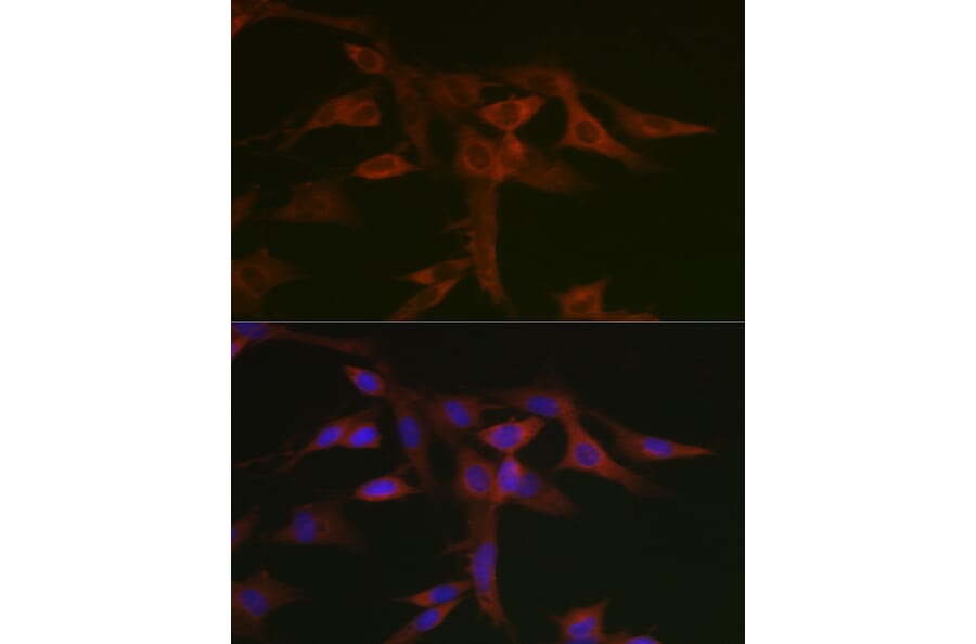 Immunofluorescence - Anti-STAT5 Antibody (A10213) - Antibodies.com