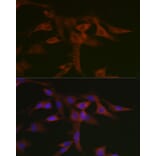 Immunofluorescence - Anti-STAT5 Antibody (A10213) - Antibodies.com