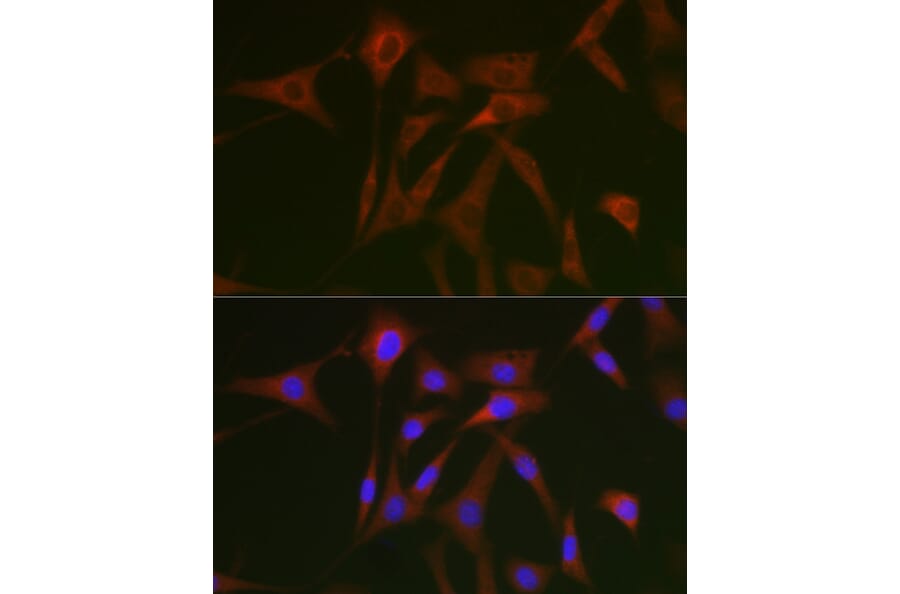 Immunofluorescence - Anti-STAT5 Antibody (A10213) - Antibodies.com