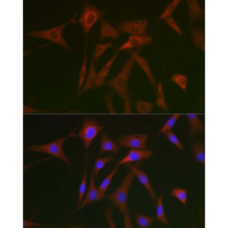 Immunofluorescence - Anti-STAT5 Antibody (A10213) - Antibodies.com