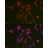 Immunofluorescence - Anti-STAT5 Antibody (A10213) - Antibodies.com