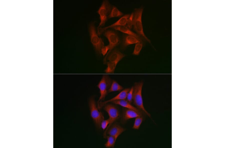 Immunofluorescence - Anti-STAT5 Antibody (A10213) - Antibodies.com