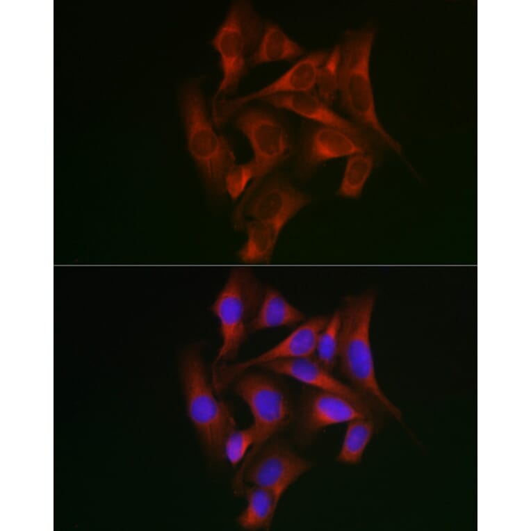 Immunofluorescence - Anti-STAT5 Antibody (A10213) - Antibodies.com