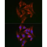 Immunofluorescence - Anti-STAT5 Antibody (A10213) - Antibodies.com