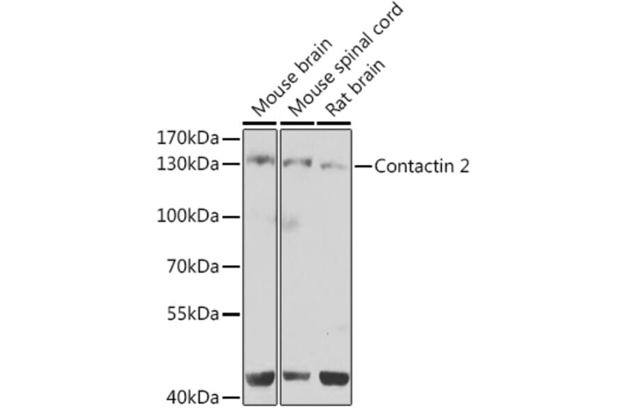Western Blot - Anti-TAG1/TAX1 Antibody (A10214) - Antibodies.com