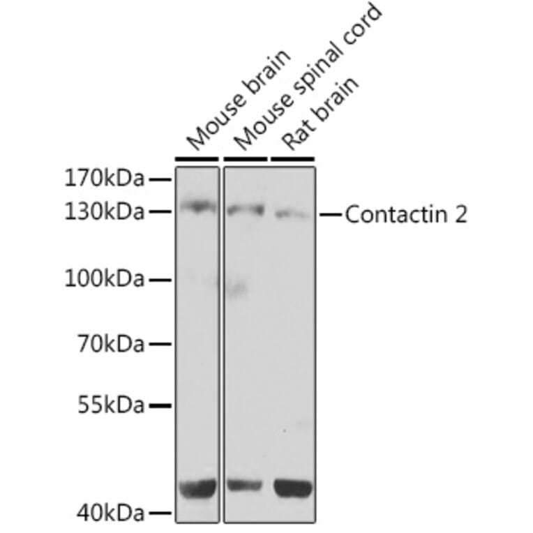 Western Blot - Anti-TAG1/TAX1 Antibody (A10214) - Antibodies.com