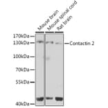 Western Blot - Anti-TAG1/TAX1 Antibody (A10214) - Antibodies.com