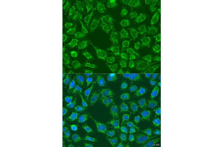 Immunofluorescence - Anti-WNT7B Antibody (A7746) - Antibodies.com