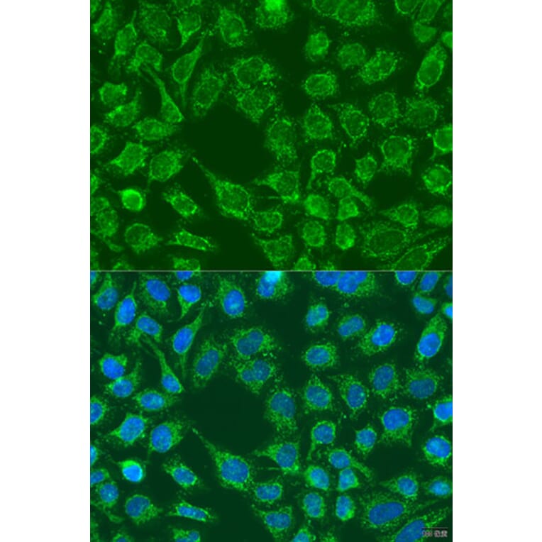 Immunofluorescence - Anti-WNT7B Antibody (A7746) - Antibodies.com