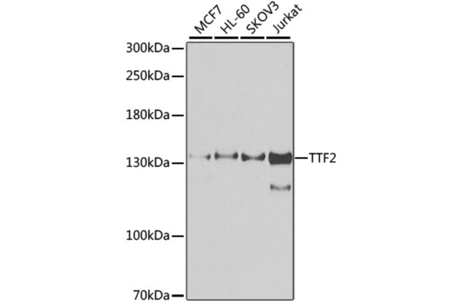 Western Blot - Anti-TTF2 Antibody (A10216) - Antibodies.com
