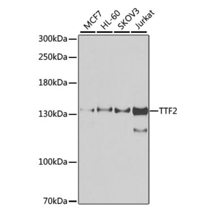 Western Blot - Anti-TTF2 Antibody (A10216) - Antibodies.com