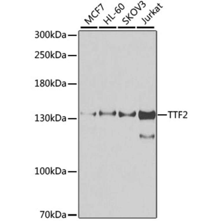 Western Blot - Anti-TTF2 Antibody (A10216) - Antibodies.com