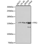 Western Blot - Anti-TTF2 Antibody (A10216) - Antibodies.com