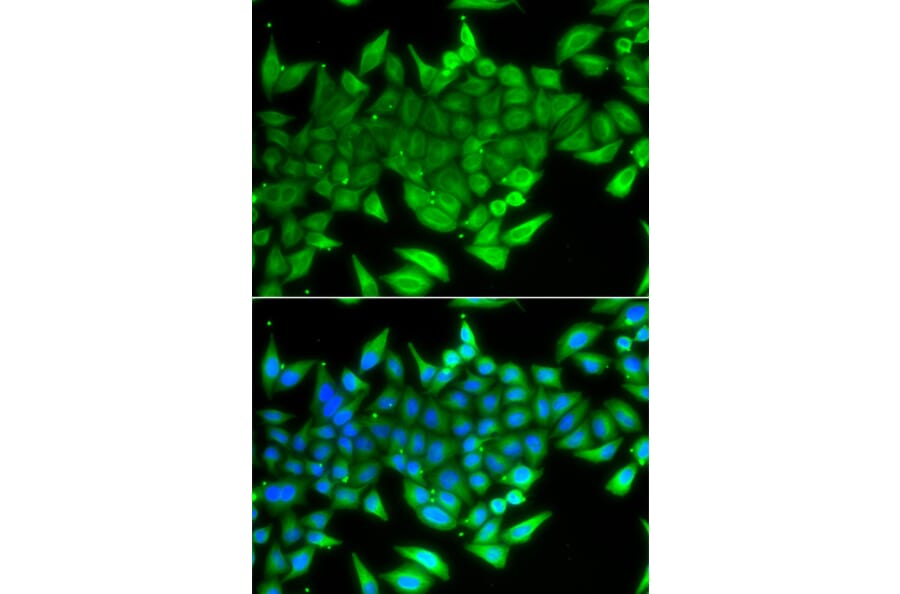 Immunofluorescence - Anti-TTF2 Antibody (A10216) - Antibodies.com