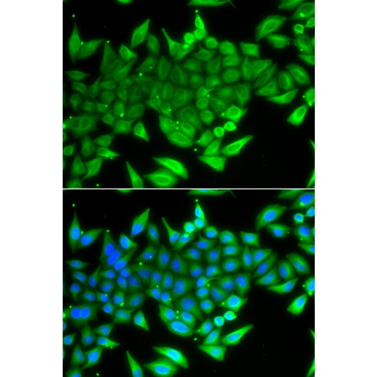Immunofluorescence - Anti-TTF2 Antibody (A10216) - Antibodies.com