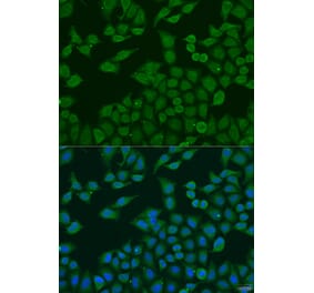 Immunofluorescence - Anti-PLA2G4C Antibody (A10217) - Antibodies.com
