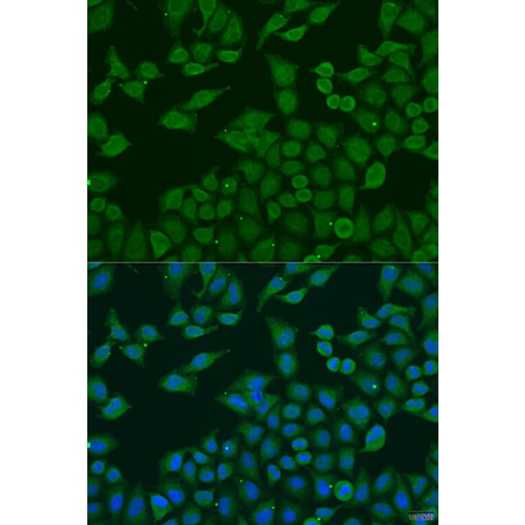 Immunofluorescence - Anti-PLA2G4C Antibody (A10217) - Antibodies.com