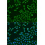 Immunofluorescence - Anti-PLA2G4C Antibody (A10217) - Antibodies.com